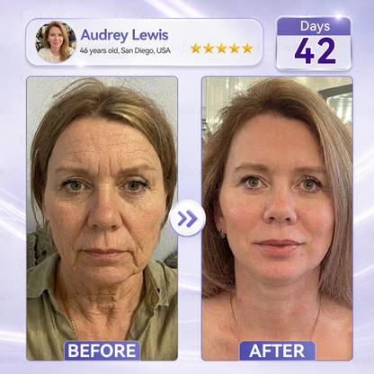 𝐆𝐚𝐟𝐚𝐜𝐞® 𝐂𝐨𝐥𝐥𝐚𝐠𝐞𝐧 & 𝐅𝐮𝐥𝐥𝐞𝐫𝐞𝐧𝐞 𝐑𝐨𝐥𝐥𝐞𝐫 𝐅𝐢𝐫𝐦𝐢𝐧𝐠 𝐂𝐫𝐞𝐚𝐦