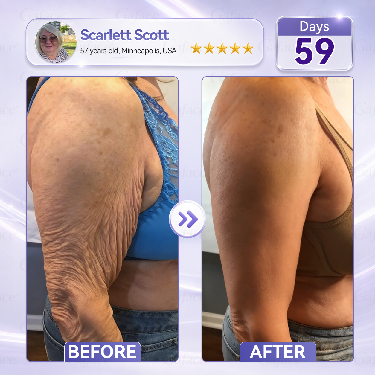 𝐆𝐚𝐟𝐚𝐜𝐞® 𝐂𝐨𝐥𝐥𝐚𝐠𝐞𝐧 & 𝐅𝐮𝐥𝐥𝐞𝐫𝐞𝐧𝐞 𝐑𝐨𝐥𝐥𝐞𝐫 𝐅𝐢𝐫𝐦𝐢𝐧𝐠 𝐂𝐫𝐞𝐚𝐦