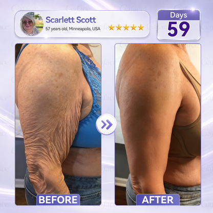 𝐆𝐚𝐟𝐚𝐜𝐞® 𝐂𝐨𝐥𝐥𝐚𝐠𝐞𝐧 & 𝐅𝐮𝐥𝐥𝐞𝐫𝐞𝐧𝐞 𝐑𝐨𝐥𝐥𝐞𝐫 𝐅𝐢𝐫𝐦𝐢𝐧𝐠 𝐂𝐫𝐞𝐚𝐦
