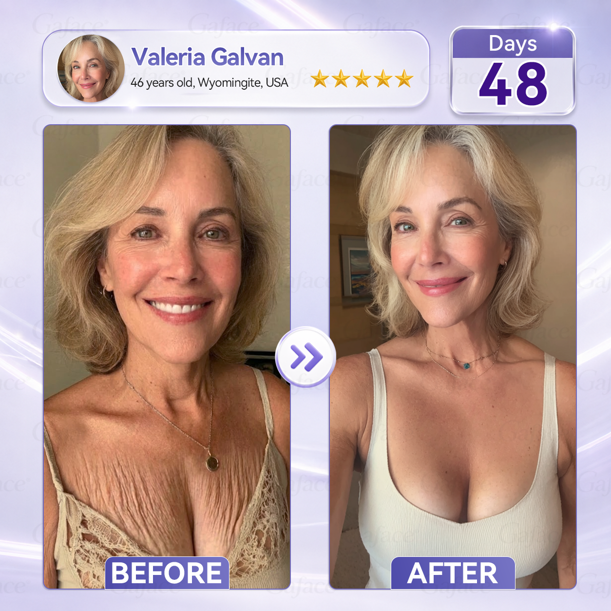𝐆𝐚𝐟𝐚𝐜𝐞® 𝐂𝐨𝐥𝐥𝐚𝐠𝐞𝐧 & 𝐅𝐮𝐥𝐥𝐞𝐫𝐞𝐧𝐞 𝐑𝐨𝐥𝐥𝐞𝐫 𝐅𝐢𝐫𝐦𝐢𝐧𝐠 𝐂𝐫𝐞𝐚𝐦