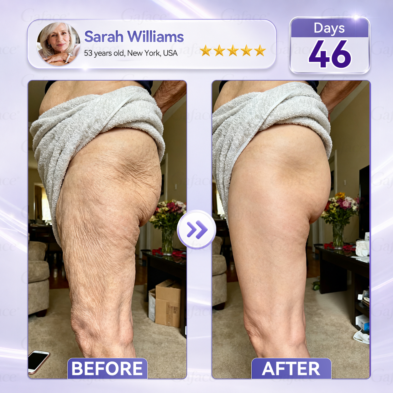 𝐆𝐚𝐟𝐚𝐜𝐞® 𝐂𝐨𝐥𝐥𝐚𝐠𝐞𝐧 & 𝐅𝐮𝐥𝐥𝐞𝐫𝐞𝐧𝐞 𝐑𝐨𝐥𝐥𝐞𝐫 𝐅𝐢𝐫𝐦𝐢𝐧𝐠 𝐂𝐫𝐞𝐚𝐦