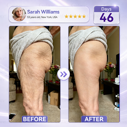 𝐆𝐚𝐟𝐚𝐜𝐞® 𝐂𝐨𝐥𝐥𝐚𝐠𝐞𝐧 & 𝐅𝐮𝐥𝐥𝐞𝐫𝐞𝐧𝐞 𝐑𝐨𝐥𝐥𝐞𝐫 𝐅𝐢𝐫𝐦𝐢𝐧𝐠 𝐂𝐫𝐞𝐚𝐦
