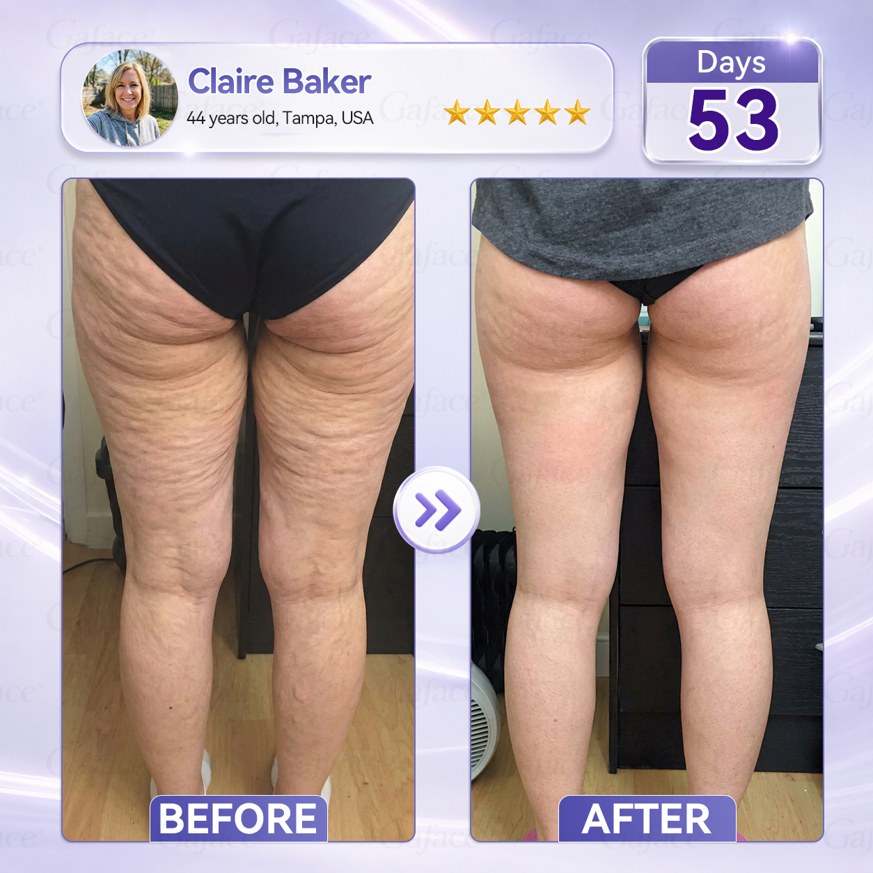 𝐆𝐚𝐟𝐚𝐜𝐞® 𝐂𝐨𝐥𝐥𝐚𝐠𝐞𝐧 & 𝐅𝐮𝐥𝐥𝐞𝐫𝐞𝐧𝐞 𝐑𝐨𝐥𝐥𝐞𝐫 𝐅𝐢𝐫𝐦𝐢𝐧𝐠 𝐂𝐫𝐞𝐚𝐦