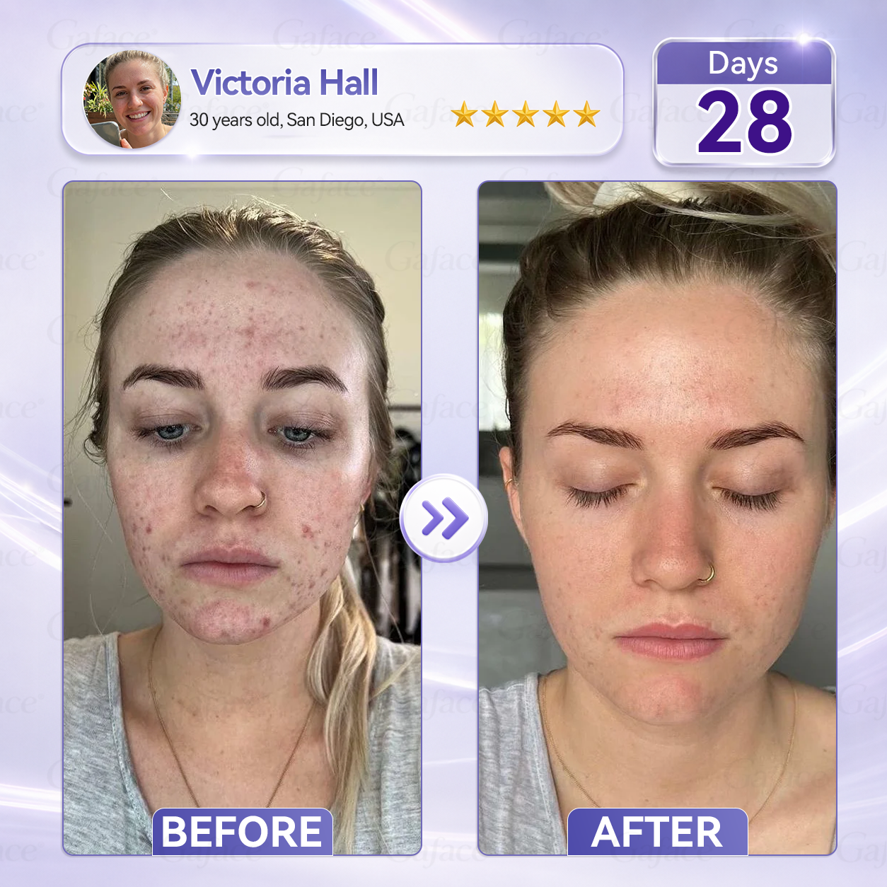 𝐆𝐚𝐟𝐚𝐜𝐞® 𝐂𝐨𝐥𝐥𝐚𝐠𝐞𝐧 & 𝐅𝐮𝐥𝐥𝐞𝐫𝐞𝐧𝐞 𝐑𝐨𝐥𝐥𝐞𝐫 𝐅𝐢𝐫𝐦𝐢𝐧𝐠 𝐂𝐫𝐞𝐚𝐦
