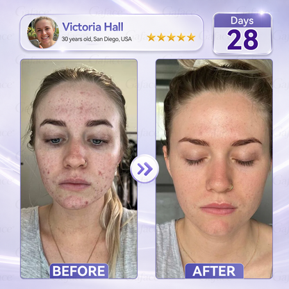 𝐆𝐚𝐟𝐚𝐜𝐞® 𝐂𝐨𝐥𝐥𝐚𝐠𝐞𝐧 & 𝐅𝐮𝐥𝐥𝐞𝐫𝐞𝐧𝐞 𝐑𝐨𝐥𝐥𝐞𝐫 𝐅𝐢𝐫𝐦𝐢𝐧𝐠 𝐂𝐫𝐞𝐚𝐦