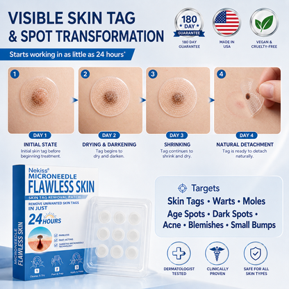 👩‍⚕️💯 𝐎𝐟𝐟𝐢𝐜𝐢𝐚𝐥 𝐒𝐭𝐨𝐫𝐞 | 𝑵𝐞𝒌𝐢𝐬𝐬® 🌿 𝐁𝐨𝐭𝐚𝐧𝐢𝐜𝐚𝐥 𝐌𝐢𝐜𝐫𝐨𝐧𝐞𝐞𝐝𝐥𝐞 𝐇𝐲𝐝𝐫𝐨𝐜𝐨𝐥𝐥𝐨𝐢𝐝 𝐏𝐚𝐭𝐜𝐡 (𝐅𝐨𝐫 𝐒𝐤𝐢𝐧 𝐓𝐚𝐠𝐬, 𝐒𝐦𝐚𝐥𝐥 𝐒𝐤𝐢𝐧 𝐆𝐫𝐨𝐰𝐭𝐡𝐬, 𝐖𝐚𝐫𝐭𝐬, 𝐌𝐨𝐥𝐞𝐬, 𝐀𝐠𝐞 𝐒𝐩𝐨𝐭𝐬 & 𝐏𝐢𝐠𝐦𝐞𝐧𝐭𝐚𝐭𝐢𝐨𝐧 𝐂𝐨𝐧𝐜𝐞𝐫𝐧𝐬)