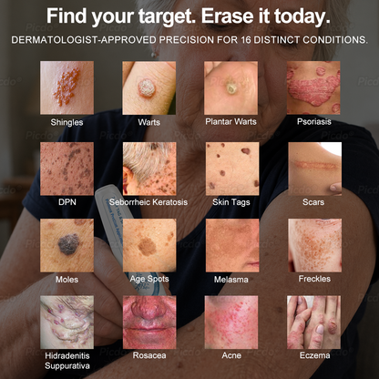 𝐏𝐈𝐂𝐃𝐎® ❼-𝗗𝗮𝘆 𝗧𝗮𝗴 & 𝗦𝗽𝗼𝘁 𝗘𝗿𝗮𝘀𝗲𝗿 (𝒁𝒆𝒓𝒐 𝑷𝒂𝒊𝒏, 𝒁𝒆𝒓𝒐 𝑺𝒄𝒂𝒓𝒔 𝑹𝒐𝒍𝒍𝒆𝒓𝒃𝒂𝒍𝒍)