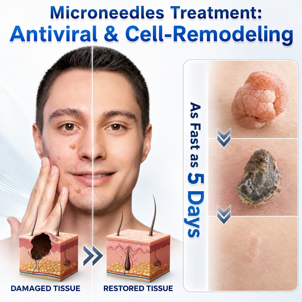 👩‍⚕️💯 𝐎𝐟𝐟𝐢𝐜𝐢𝐚𝐥 𝐒𝐭𝐨𝐫𝐞 | 𝑵𝐞𝒌𝐢𝐬𝐬® 🌿 𝐁𝐨𝐭𝐚𝐧𝐢𝐜𝐚𝐥 𝐌𝐢𝐜𝐫𝐨𝐧𝐞𝐞𝐝𝐥𝐞 𝐇𝐲𝐝𝐫𝐨𝐜𝐨𝐥𝐥𝐨𝐢𝐝 𝐏𝐚𝐭𝐜𝐡 (𝐅𝐨𝐫 𝐒𝐤𝐢𝐧 𝐓𝐚𝐠𝐬, 𝐒𝐦𝐚𝐥𝐥 𝐒𝐤𝐢𝐧 𝐆𝐫𝐨𝐰𝐭𝐡𝐬, 𝐖𝐚𝐫𝐭𝐬, 𝐌𝐨𝐥𝐞𝐬, 𝐀𝐠𝐞 𝐒𝐩𝐨𝐭𝐬 & 𝐏𝐢𝐠𝐦𝐞𝐧𝐭𝐚𝐭𝐢𝐨𝐧 𝐂𝐨𝐧𝐜𝐞𝐫𝐧𝐬)