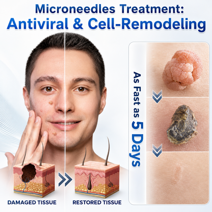 👩‍⚕️💯 𝐎𝐟𝐟𝐢𝐜𝐢𝐚𝐥 𝐒𝐭𝐨𝐫𝐞 | 𝑵𝐞𝒌𝐢𝐬𝐬® 🌿 𝐁𝐨𝐭𝐚𝐧𝐢𝐜𝐚𝐥 𝐌𝐢𝐜𝐫𝐨𝐧𝐞𝐞𝐝𝐥𝐞 𝐇𝐲𝐝𝐫𝐨𝐜𝐨𝐥𝐥𝐨𝐢𝐝 𝐏𝐚𝐭𝐜𝐡 (𝐅𝐨𝐫 𝐒𝐤𝐢𝐧 𝐓𝐚𝐠𝐬, 𝐒𝐦𝐚𝐥𝐥 𝐒𝐤𝐢𝐧 𝐆𝐫𝐨𝐰𝐭𝐡𝐬, 𝐖𝐚𝐫𝐭𝐬, 𝐌𝐨𝐥𝐞𝐬, 𝐀𝐠𝐞 𝐒𝐩𝐨𝐭𝐬 & 𝐏𝐢𝐠𝐦𝐞𝐧𝐭𝐚𝐭𝐢𝐨𝐧 𝐂𝐨𝐧𝐜𝐞𝐫𝐧𝐬)