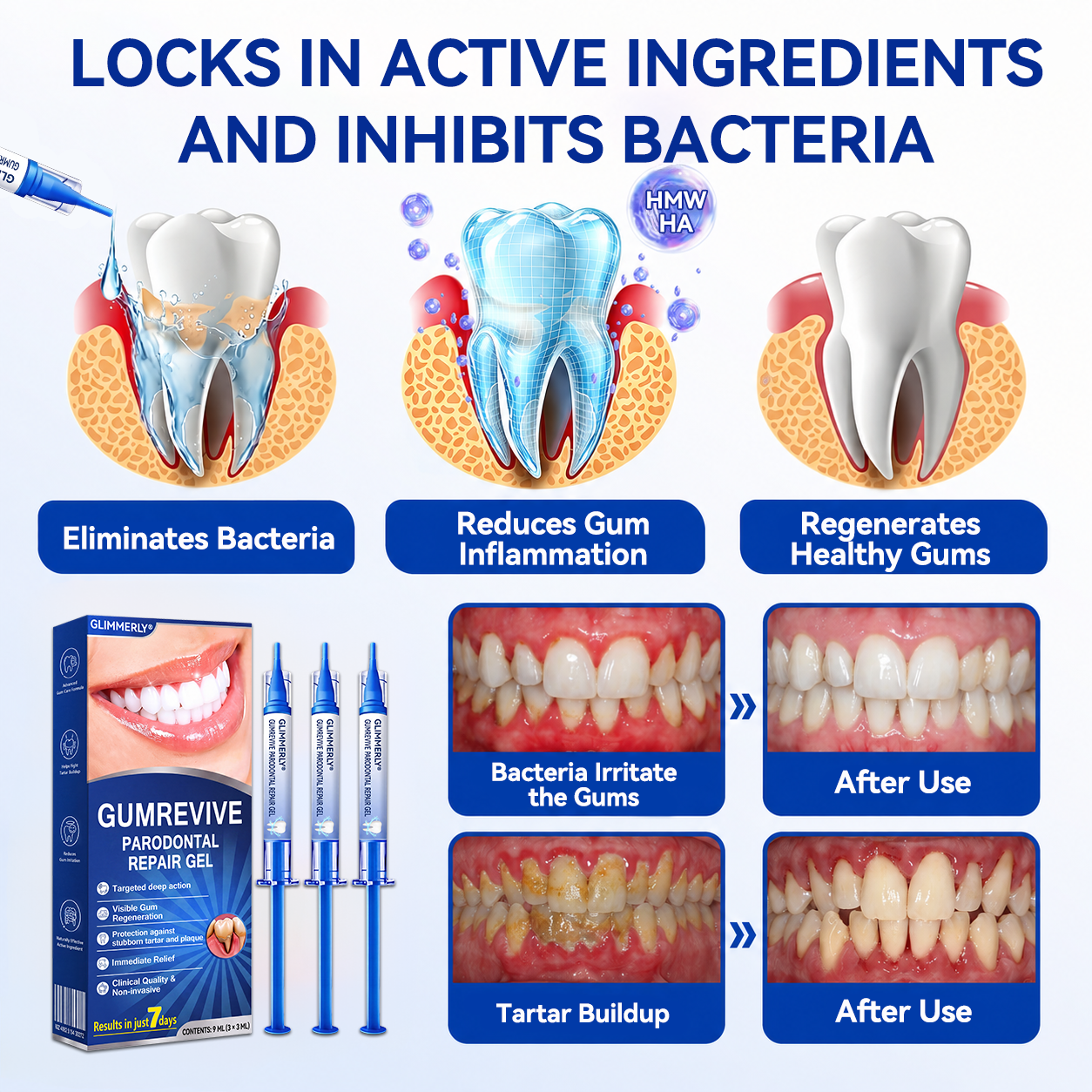 🦷𝑮𝒍𝒊𝒎𝒎𝒆𝒓𝒍𝒚®𝑮𝒖𝒎𝑹𝒆𝒗𝒊𝒗𝒆 𝑷𝒆𝒓𝒊𝒐𝒅𝒐𝒏𝒕𝒊𝒂 𝑹𝒂𝒑𝒂𝒊𝒓 𝑮𝒆𝒍