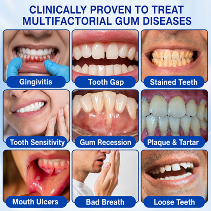 🦷𝑮𝒍𝒊𝒎𝒎𝒆𝒓𝒍𝒚®𝑮𝒖𝒎𝑹𝒆𝒗𝒊𝒗𝒆 𝑷𝒆𝒓𝒊𝒐𝒅𝒐𝒏𝒕𝒊𝒂 𝑹𝒂𝒑𝒂𝒊𝒓 𝑮𝒆𝒍